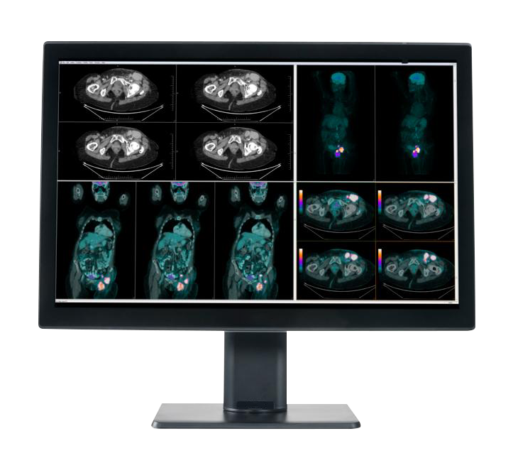 Full HD DICOM medical display